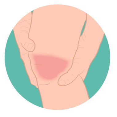 grafik resmi bacak vektör illüstrasyonunda tendon diz eklemi sorunları