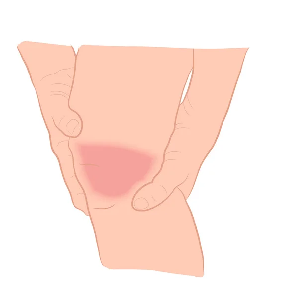 Картинка Tendon Bone Knee Joint Problems Leg Vector Illustration — стоковый вектор