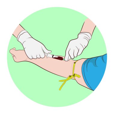 Vektör illüstrasyon görüntüsü bir doktorun cesedi incelemek için bir dedektiften kan almak için iğneyi kullanması.