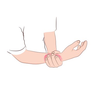 Görüntü grafik vektörü ana hatları Bilek ağrısı genellikle ani yaralanmalardan kaynaklanan kırıklar veya burkulmalardan kaynaklanır.