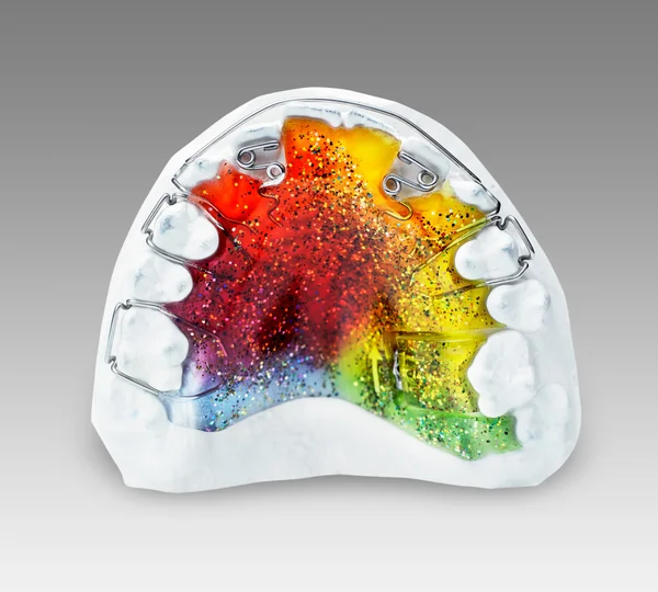 bir çocuk için çok renkli ve parıldayan bir ortodontik uygulama