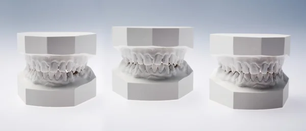 Front view of a plaster study models — Stock Photo, Image