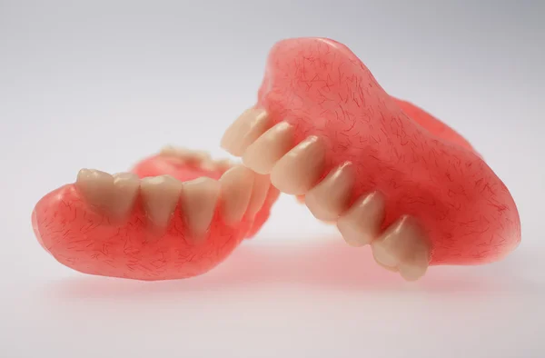 Un conjunto de prótesis dentales — Foto de Stock