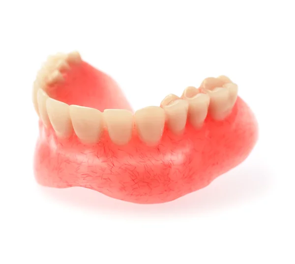 Una dentadura superior sobre fondo blanco — Foto de Stock