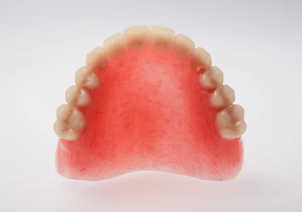 Uma dentadura superior sobre fundo branco — Fotografia de Stock