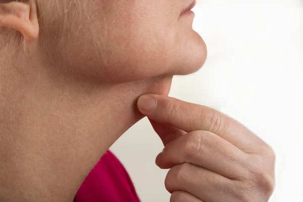 Female double chin from profile for the surgery