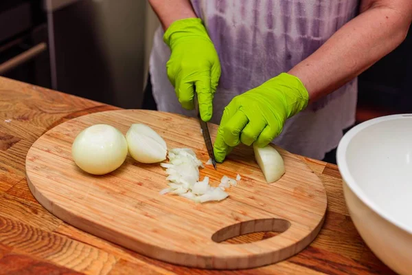 Vista Cerca Las Manos Femeninas Pelando Cebollas Concepto Cocina —  Fotos de Stock