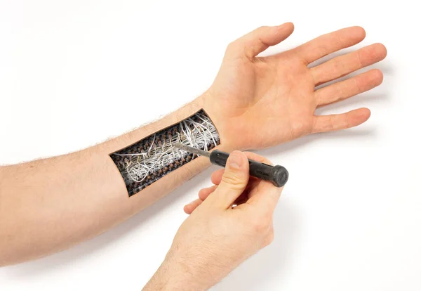 Mão Robô Dentro Mão Humana Conceito Prótese Reparação Isolado Branco — Fotografia de Stock