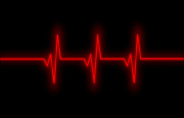 Elektrocardiogram - Concept van de gezondheidszorg — Stockfoto