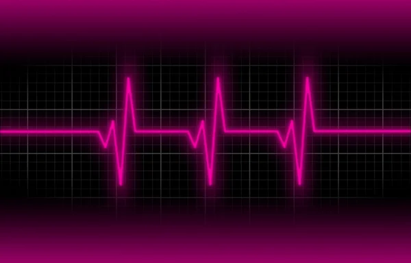 Electrocardiogram - Concept of healthcare — Stock Photo, Image