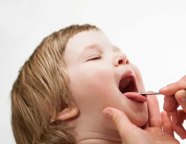 Undersöka lilla flickans hals — Stockfoto