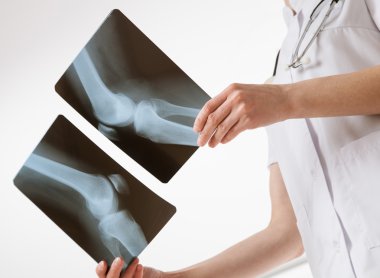 Doktor Röntgen karşılaştırma
