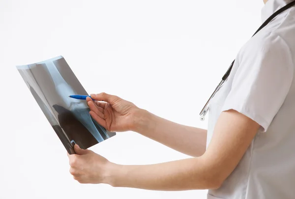 Médico examinando um raio-X — Fotografia de Stock