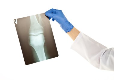 Doktor röntgeni inceliyor.