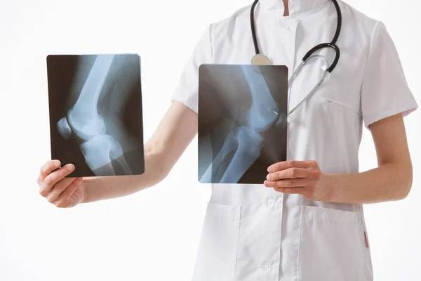 Doctor comparing X-rays — Stock Photo, Image