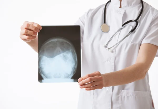 Médico examinando una radiografía — Foto de Stock