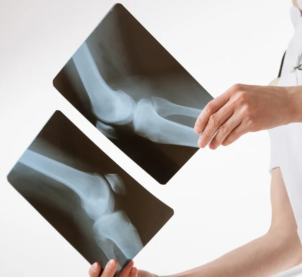 Doctor comparing X-rays — Stock Photo, Image