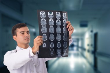 Beyin xray film tarama. Hastanın hastanede doktor analiz başkanı.