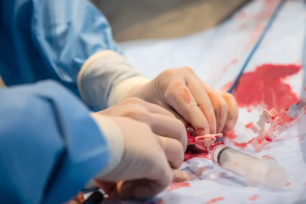 Dotor Prepara Equipo Para Angioplastia Coronaria Tranluminal Percutánea Para Operar — Foto de Stock