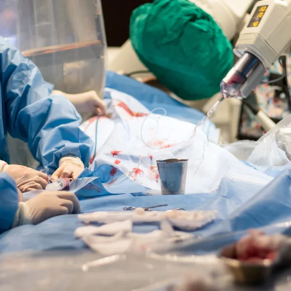 Angiographie Cardiaque Pour Les Personnes Traitées — Photo