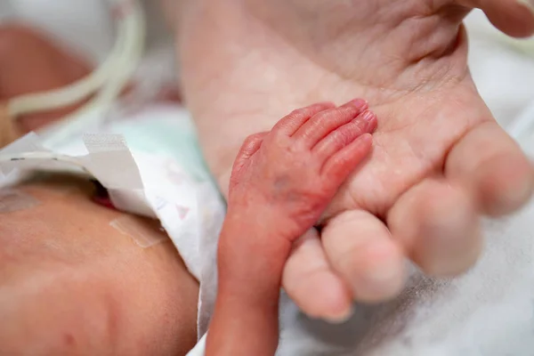 Newborn neonatal infant pulse oximeter premature baby.Mother holding her children inside incubator.