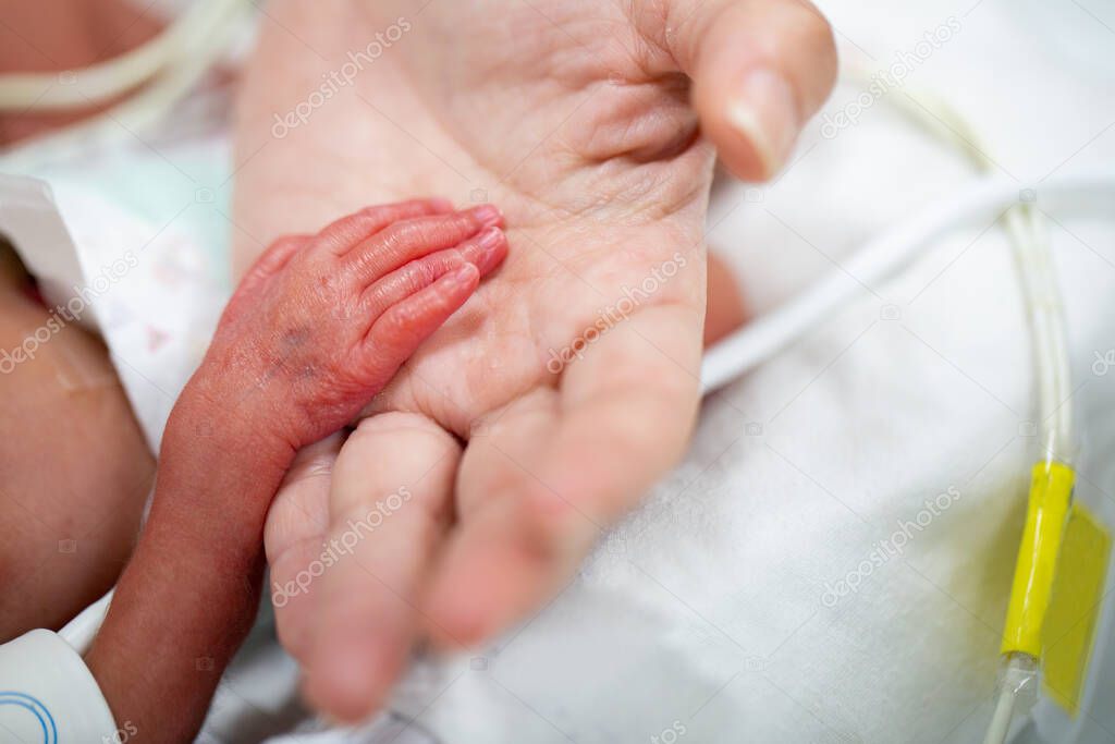 Newborn neonatal infant pulse oximeter premature baby.Mother holding her children inside incubator.
