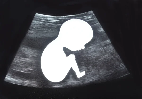 Tutup Ultrasound Gambar bayi — Stok Foto