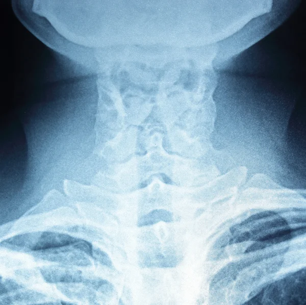 Röntgenfilm aus nächster Nähe — Stockfoto