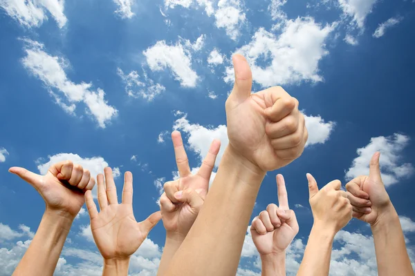 People show hands for agree your offer good conditional — Stock Photo, Image