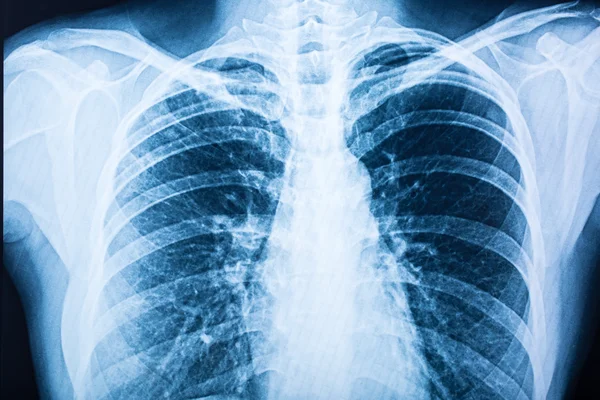 X-ray — Stock Photo, Image