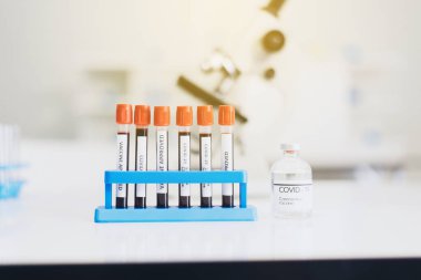 Laboratuvarda Coronavirus kan testi için rafta kan testi tüpü var.