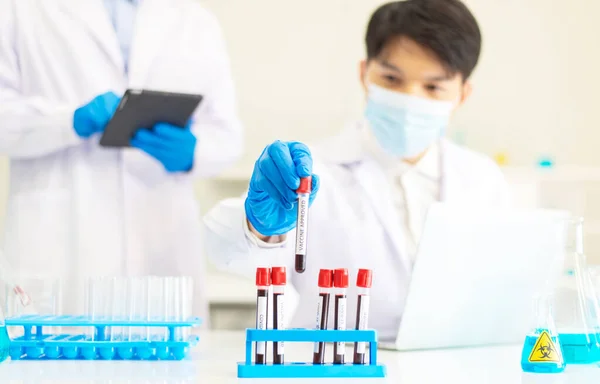 Chemist Asian Man Hands Holding Test Tube Research Coronavirus Blood — Stock Photo, Image