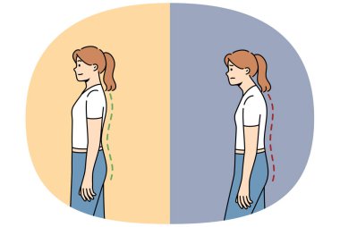 Skolyoz ya da kadında osteokondrosis, kondisyon ve ağrılı omurga problemleri nedeniyle, ki bu da fitness yaptıktan sonra düzeldi. Oturaklı yaşam tarzı nedeniyle kadın ofis çalışanlarında skolyoz sorunu