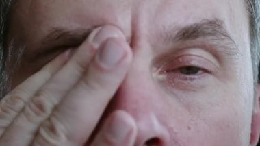 Close up of a mans eyes that are itchy and burning after a hard working day, problems with the eyes because of working behind the monitor. High-quality 4k footage