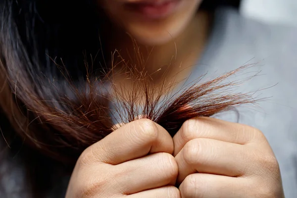 Una Mujer Con Pérdida Cabello Alérgica Champú Acondicionador — Foto de Stock