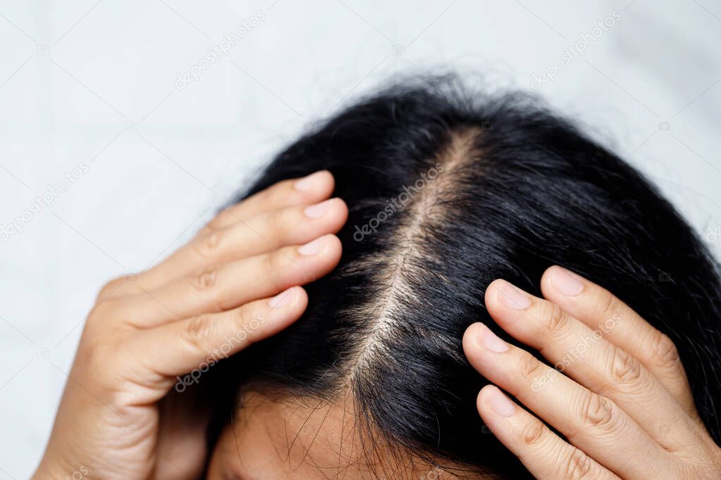 A woman with hair loss, she's allergic to shampoo and conditioner.
