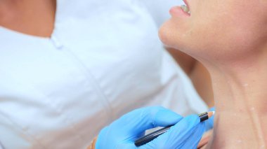  Güzellik uzmanı kadının yüzündeki iğne noktalarını kurşun kalemle işaretliyor.