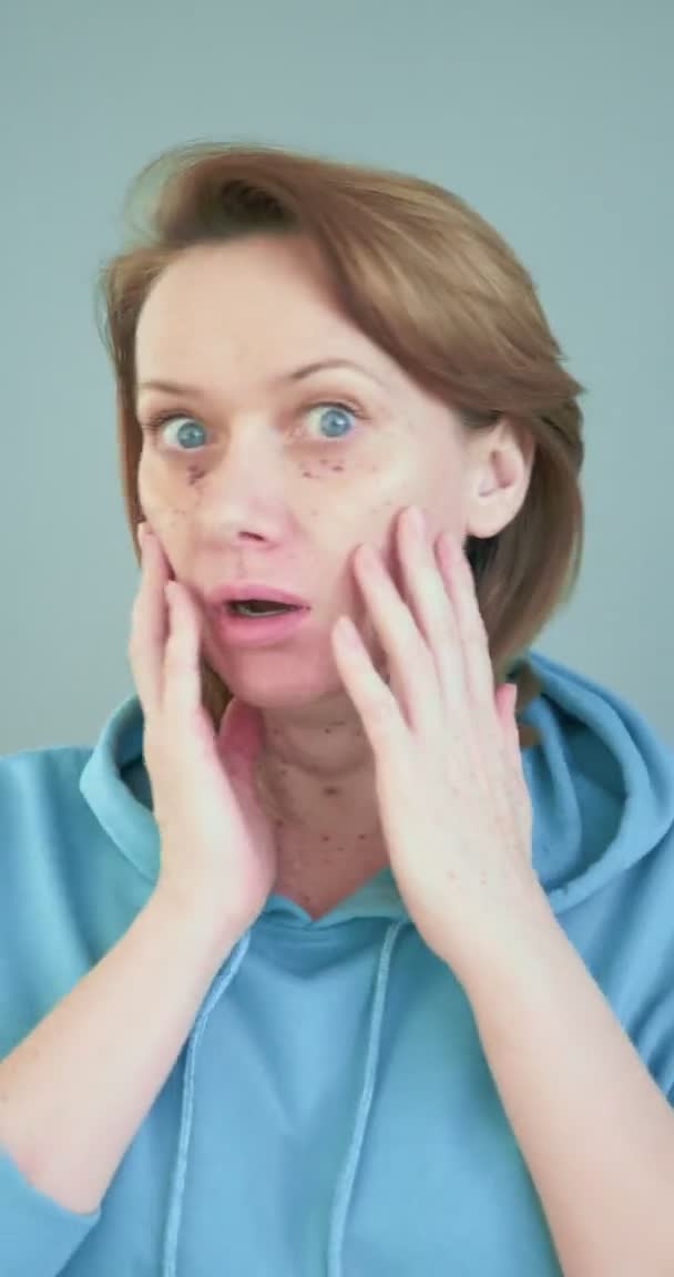 Verticalement, portrait d'une femme avec des ecchymoses provenant d'injections cosmétiques — Video