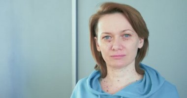 Kozmetik iğnelerden dolayı çürükleri olan bir kadının portresi.