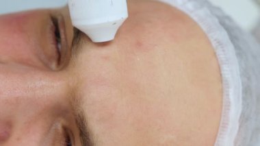 Güzellik uzmanının resepsiyonunda bir adamın yüzüne yakın çekim. Sıkıştırılmış hava ile enjeksiyon olmayan kozmetoloji. İğne olmayan enjeksiyonların tanıtımı 