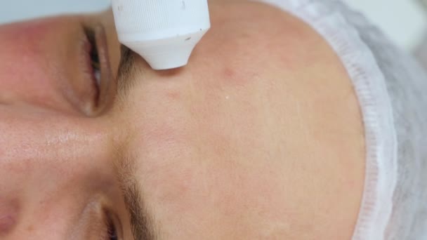 Närbild av en mans ansikte vid mottagningen av en kosmetolog. Icke-injektionsapparatens kosmetologi med tryckluft. Införande av injektioner utan nål — Stockvideo