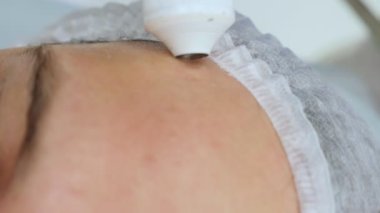 Güzellik uzmanının resepsiyonunda bir adamın yüzüne yakın çekim. Sıkıştırılmış hava ile enjeksiyon olmayan kozmetoloji. İğne olmayan enjeksiyonların tanıtımı 