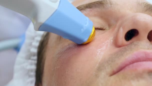 Крупним планом обличчя чоловіка на прийомі косметолога, який отримує апаратну косметологічну процедуру ультразвукова термоліфтинг — стокове відео