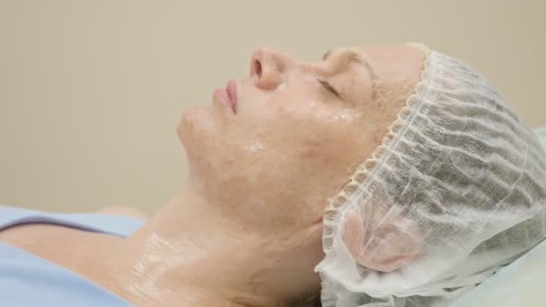 Временной промежуток. процесс высыхания сыворотки на лице женщины во время ферментной терапии — стоковое видео