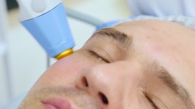 Güzellik uzmanının resepsiyonunda bir adamın yüzüne yakın çekim. Donanım kozmetoloji prosedürü ultrasonik termokaldırma uygulanıyor.