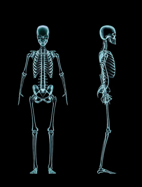 Esqueleto feminino raio-x de corpo inteiro — Fotografia de Stock