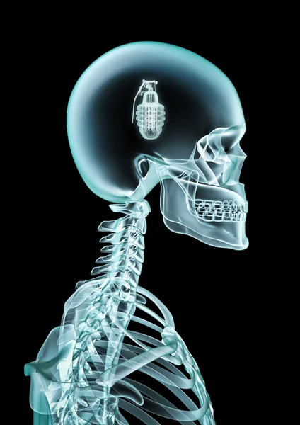 X-ray granat — Stockfoto