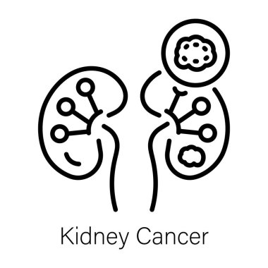 Böbrek kanserinin çizgi stili.