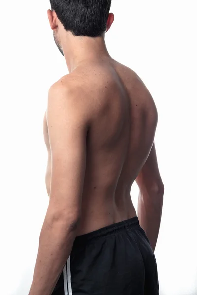 Scoliosi, uomo magro sulla schiena, niente camicia. curvatura della rotazione — Foto Stock