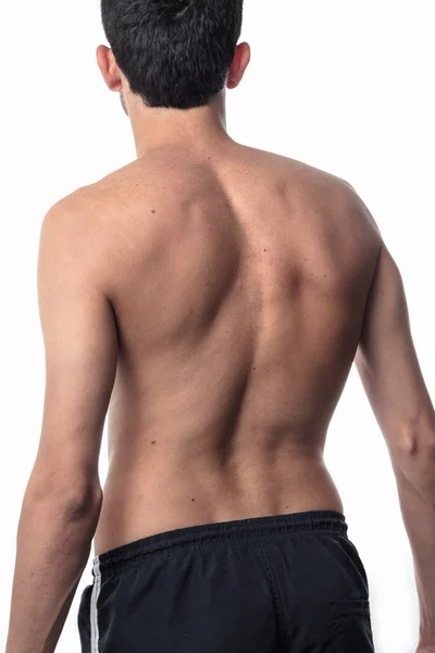 Scoliosi, uomo magro sulla schiena, niente camicia. curvatura della rotazione — Foto Stock